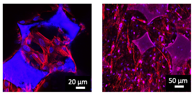 colonisation-cellulaire-au-sein-des-materiaux-poreux