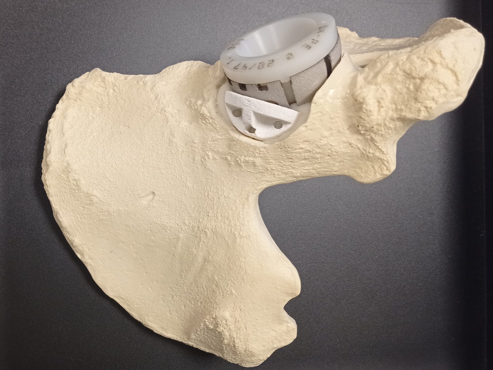 OptimOs : nouvelles architectures biocompatibles pour la régénération ...