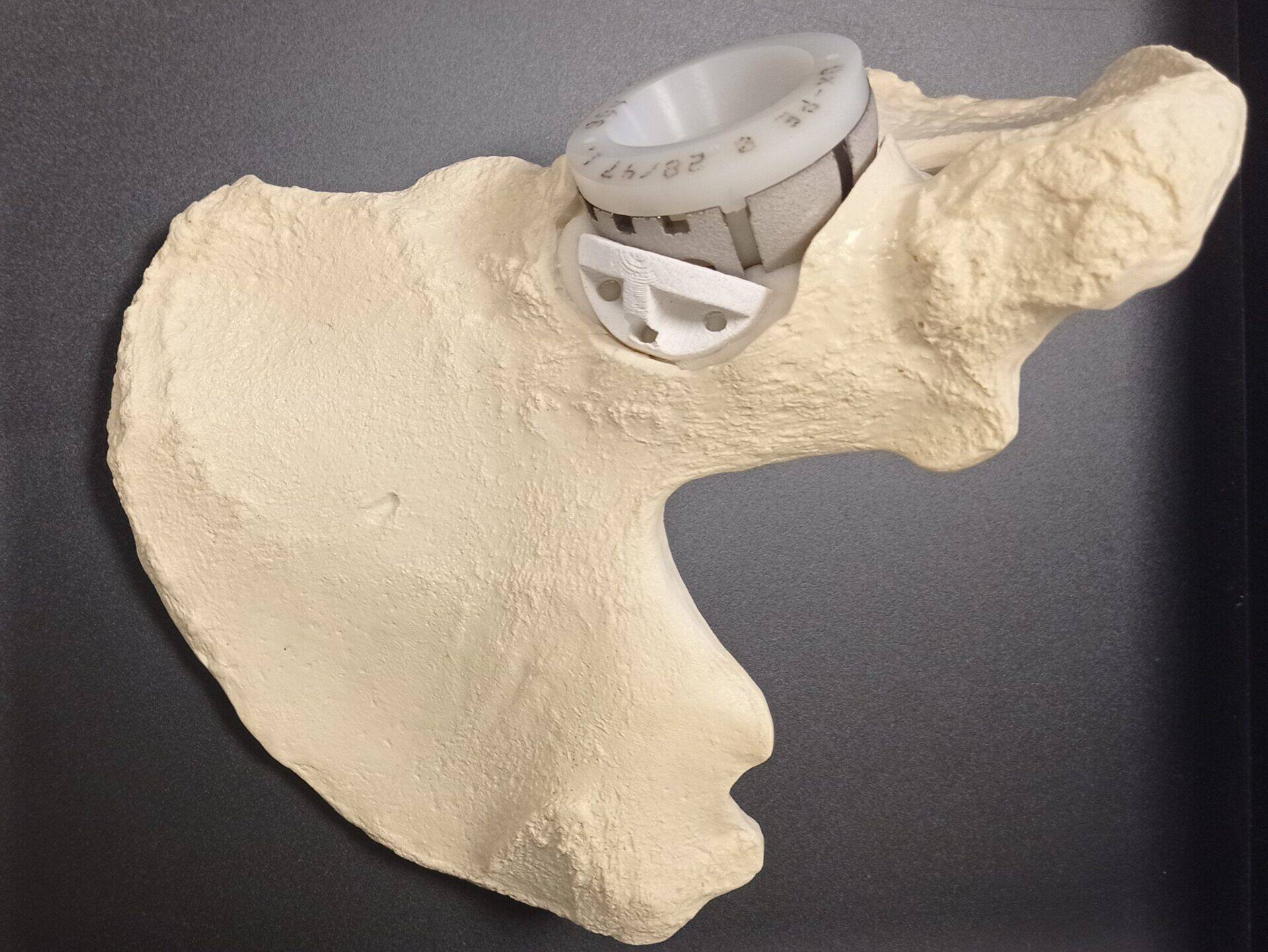 Projet OptimOs – Une avancée majeure dans la Régénération Osseuse