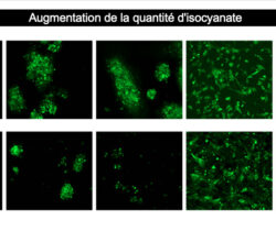 DIAART : diaphragme pour la hernie diaphragmatique congénitale