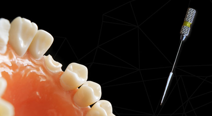 ELECTRATPULP : révolutionner les soins endodontiques