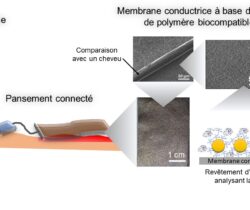 Pansement connecté pour le suivi de la guérison