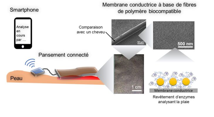 Pansement connecté pour le suivi de la guérison